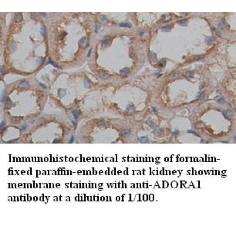 ADORA1 Antibody from Signalway Antibody (39355) - Antibodies.com