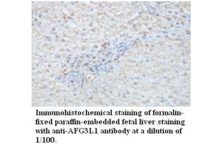 AFG3L1 Antibody from Signalway Antibody (39716) - Antibodies.com