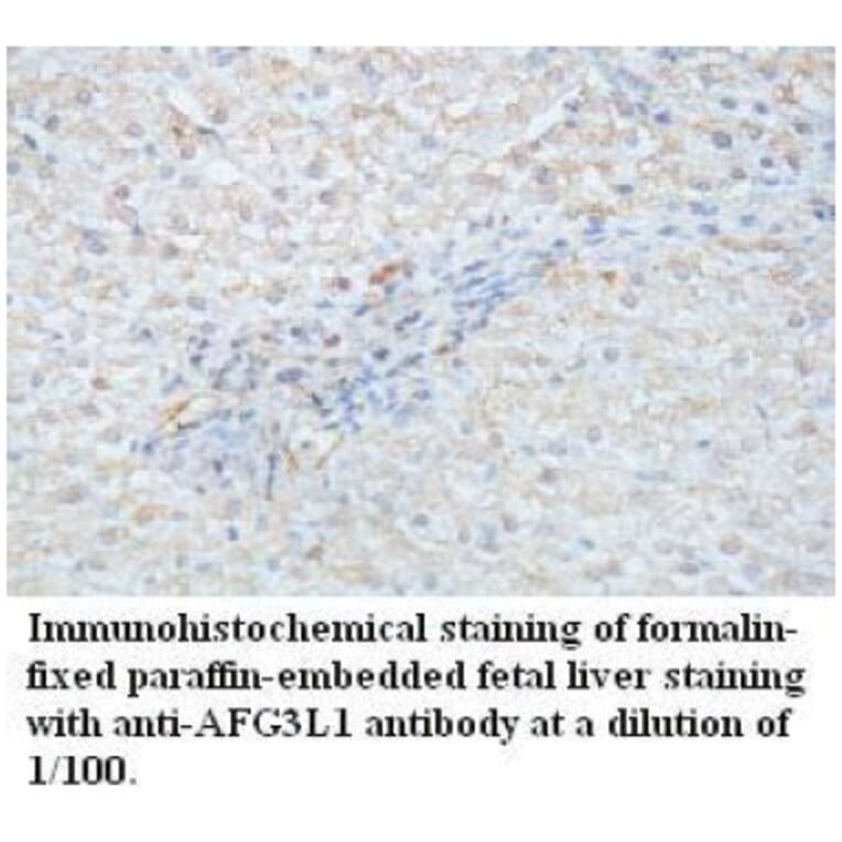 AFG3L1 Antibody from Signalway Antibody (39716) - Antibodies.com