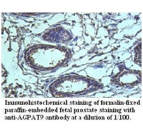 AGPAT9 Antibody from Signalway Antibody (39720) - Antibodies.com