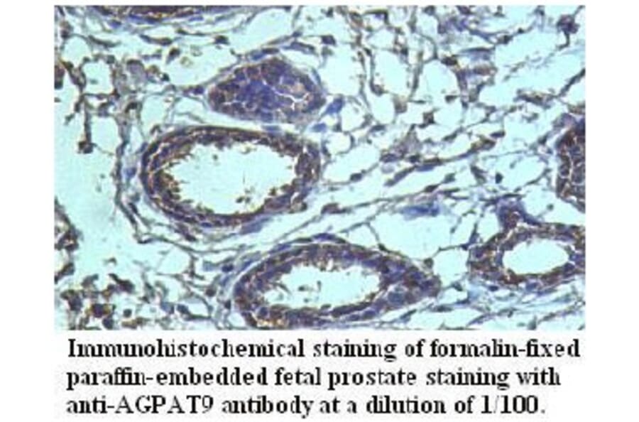 AGPAT9 Antibody from Signalway Antibody (39720) - Antibodies.com