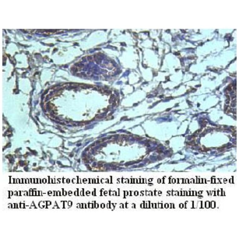 AGPAT9 Antibody from Signalway Antibody (39720) - Antibodies.com