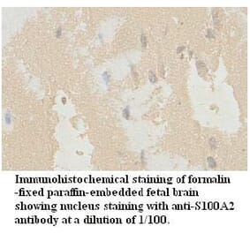 S100A2 Antibody from Signalway Antibody (39724) - Antibodies.com