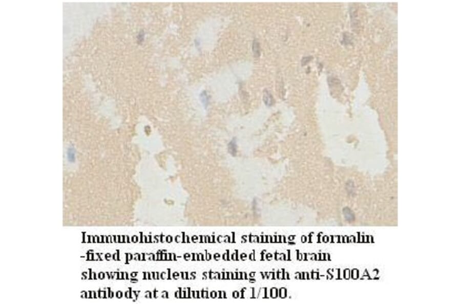 S100A2 Antibody from Signalway Antibody (39724) - Antibodies.com
