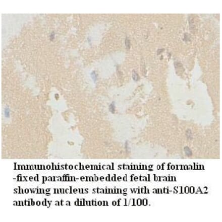 S100A2 Antibody from Signalway Antibody (39724) - Antibodies.com