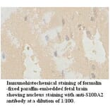 S100A2 Antibody from Signalway Antibody (39724) - Antibodies.com