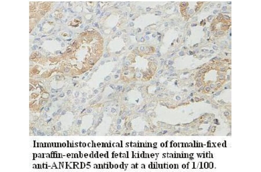 ANKRD5 Antibody from Signalway Antibody (39727) - Antibodies.com