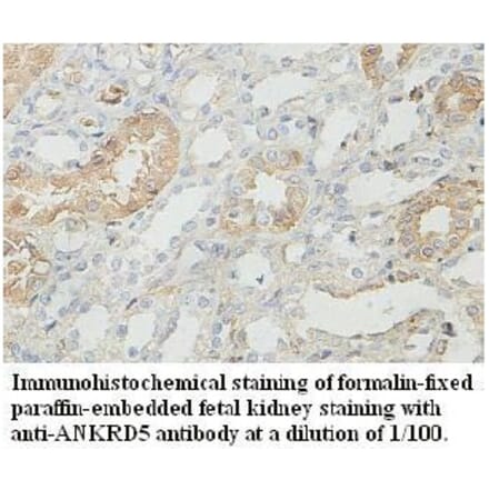 ANKRD5 Antibody from Signalway Antibody (39727) - Antibodies.com