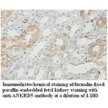 ANKRD5 Antibody from Signalway Antibody (39727) - Antibodies.com