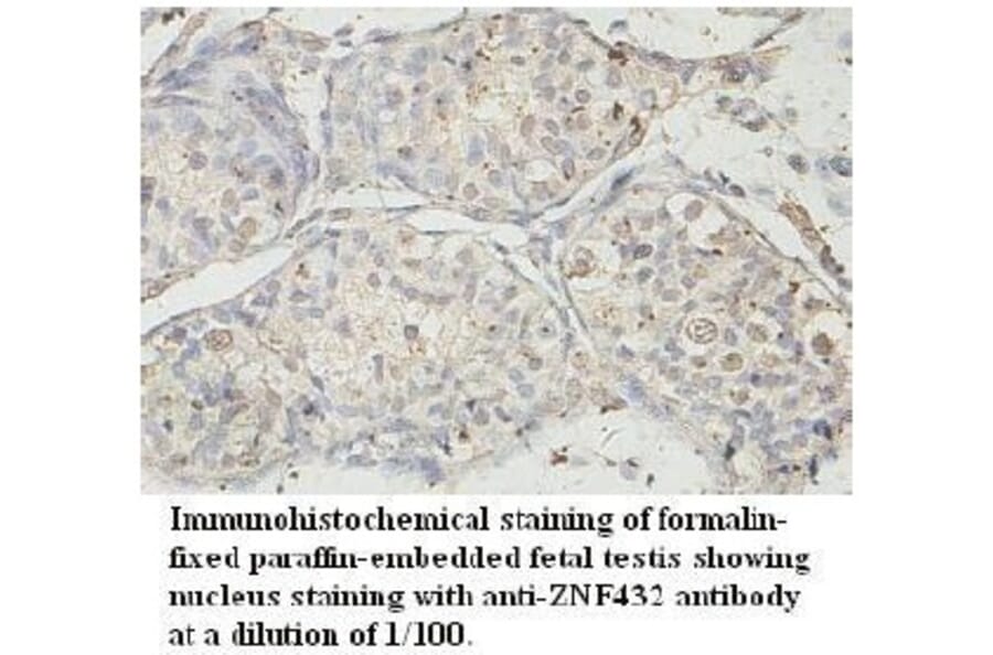 ZNF432 Antibody from Signalway Antibody (39728) - Antibodies.com