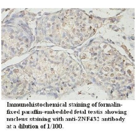 ZNF432 Antibody from Signalway Antibody (39728) - Antibodies.com