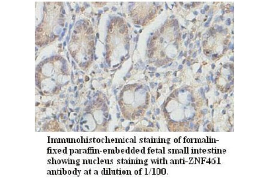ZNF461 Antibody from Signalway Antibody (39729) - Antibodies.com