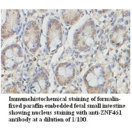 ZNF461 Antibody from Signalway Antibody (39729) - Antibodies.com