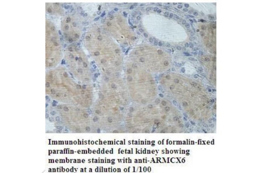 ARMCX6 Antibody from Signalway Antibody (39936) - Antibodies.com