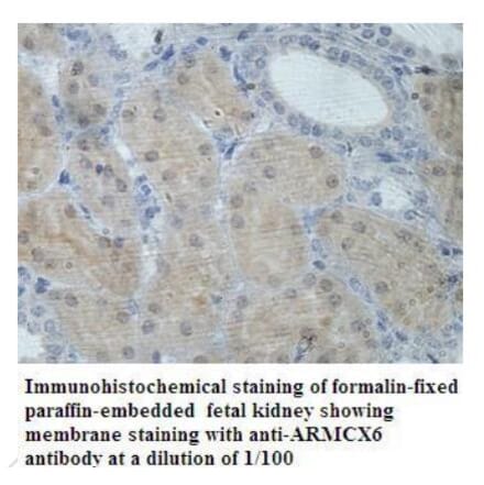 ARMCX6 Antibody from Signalway Antibody (39936) - Antibodies.com