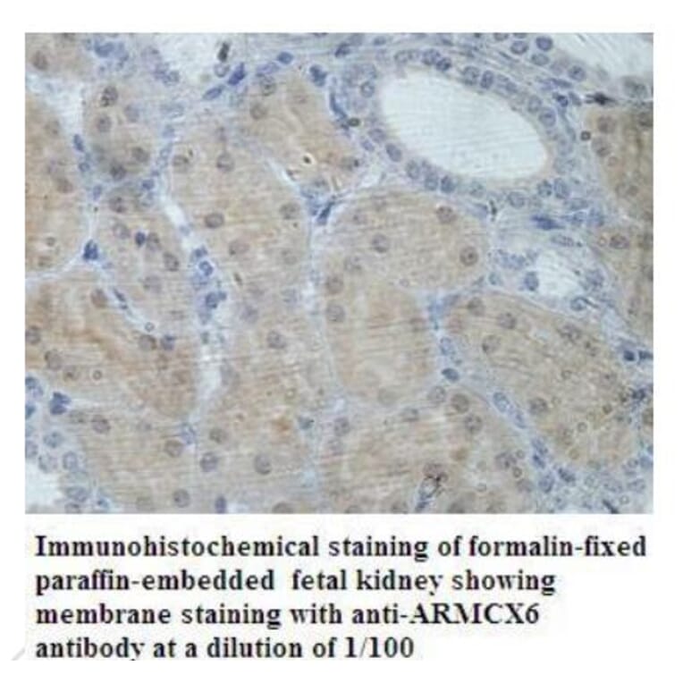 ARMCX6 Antibody from Signalway Antibody (39936) - Antibodies.com