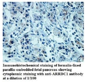 ARRDC1 Antibody from Signalway Antibody (39939) - Antibodies.com