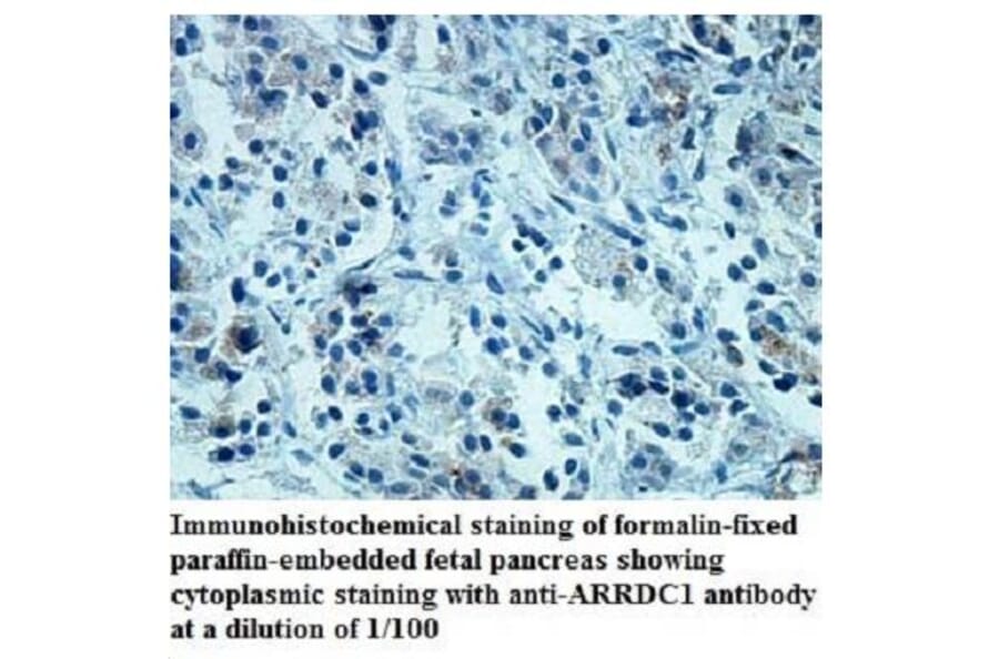 ARRDC1 Antibody from Signalway Antibody (39939) - Antibodies.com
