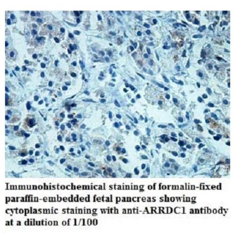 ARRDC1 Antibody from Signalway Antibody (39939) - Antibodies.com