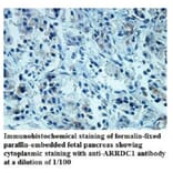 ARRDC1 Antibody from Signalway Antibody (39939) - Antibodies.com