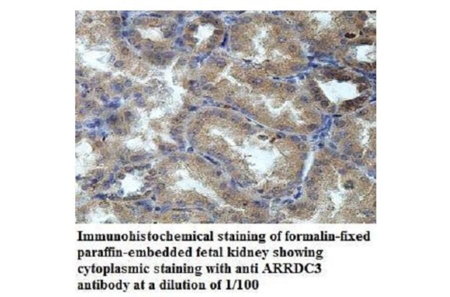 ARRDC3 Antibody from Signalway Antibody (39947) - Antibodies.com