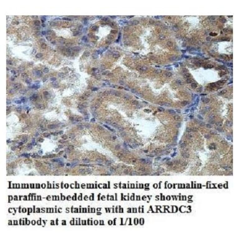 ARRDC3 Antibody from Signalway Antibody (39947) - Antibodies.com