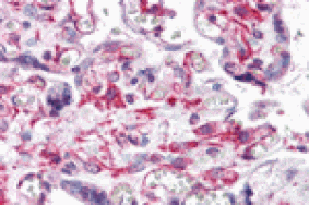 Immunohistochemistry - RUSC2 Antibody from Signalway Antibody (24976) - Antibodies.com