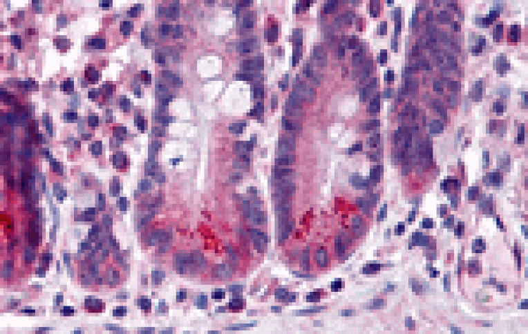 Immunohistochemistry - BRUCE Antibody from Signalway Antibody (25439) - Antibodies.com