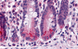 Immunohistochemistry - BRUCE Antibody from Signalway Antibody (25439) - Antibodies.com
