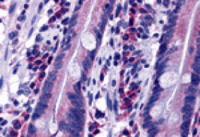 Immunohistochemistry - DISP2 Antibody from Signalway Antibody (25446) - Antibodies.com