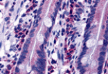 Immunohistochemistry - DISP2 Antibody from Signalway Antibody (25446) - Antibodies.com