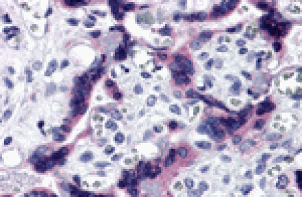 Immunohistochemistry - TTBK2 Antibody from Signalway Antibody (25447) - Antibodies.com