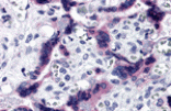 Immunohistochemistry - TTBK2 Antibody from Signalway Antibody (25447) - Antibodies.com