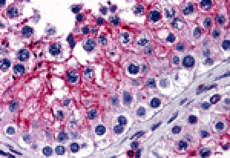 Immunohistochemistry - KPNA5 Antibody from Signalway Antibody (25451) - Antibodies.com