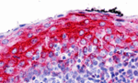 Immunohistochemistry - ZMYM4 Antibody from Signalway Antibody (25456) - Antibodies.com