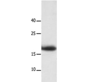 LAIR2 Antibody from Signalway Antibody (31227) - Antibodies.com