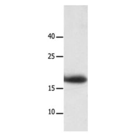 LAIR2 Antibody from Signalway Antibody (31227) - Antibodies.com