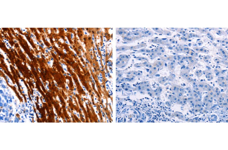 LAIR2 Antibody from Signalway Antibody (31227) - Antibodies.com