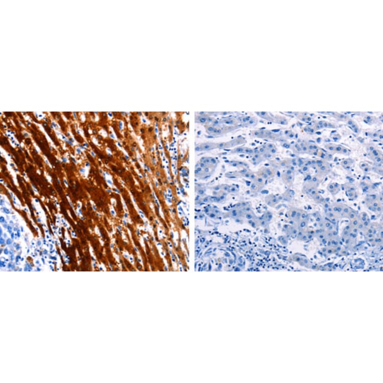 LAIR2 Antibody from Signalway Antibody (31227) - Antibodies.com