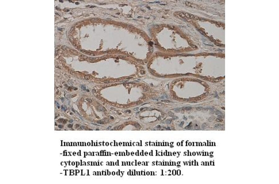 TBPL1 Antibody from Signalway Antibody (39328) - Antibodies.com