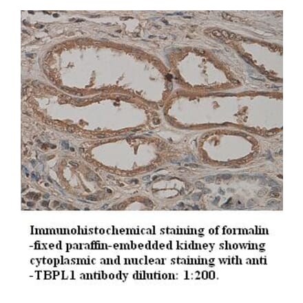 TBPL1 Antibody from Signalway Antibody (39328) - Antibodies.com