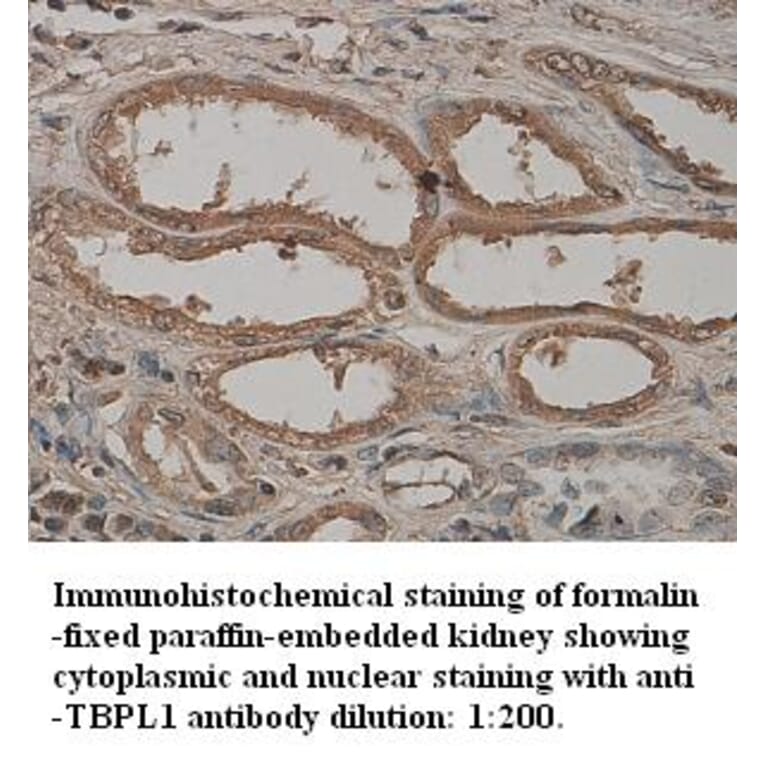 TBPL1 Antibody from Signalway Antibody (39328) - Antibodies.com