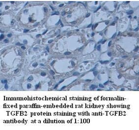 TGFB2 Antibody from Signalway Antibody (39337) - Antibodies.com