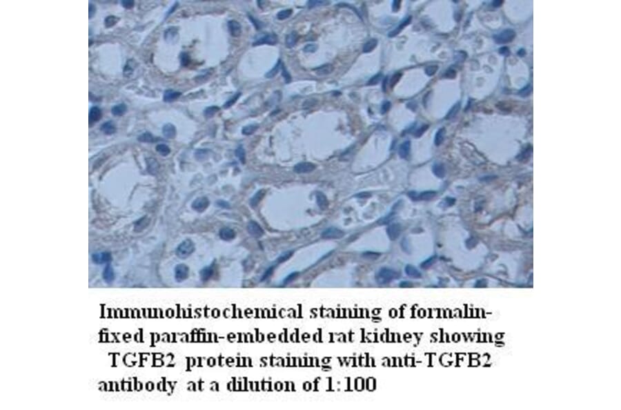 TGFB2 Antibody from Signalway Antibody (39337) - Antibodies.com
