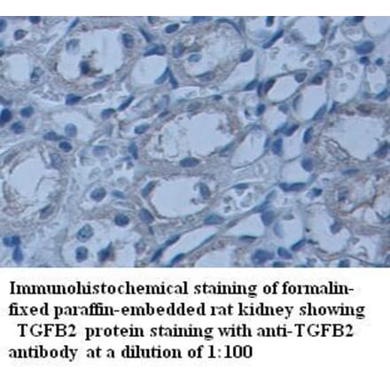 TGFB2 Antibody from Signalway Antibody (39337) - Antibodies.com