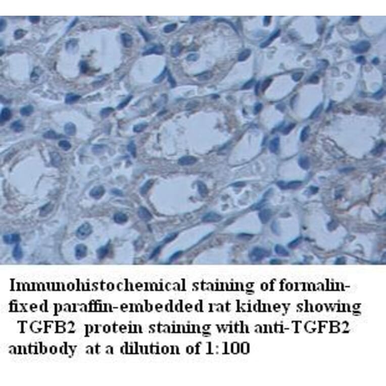 TGFB2 Antibody from Signalway Antibody (39337) - Antibodies.com
