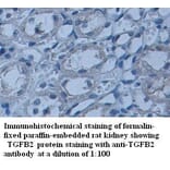 TGFB2 Antibody from Signalway Antibody (39337) - Antibodies.com