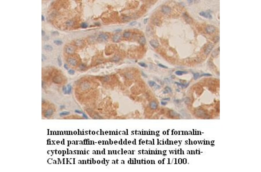 CaMKI Antibody from Signalway Antibody (39358) - Antibodies.com