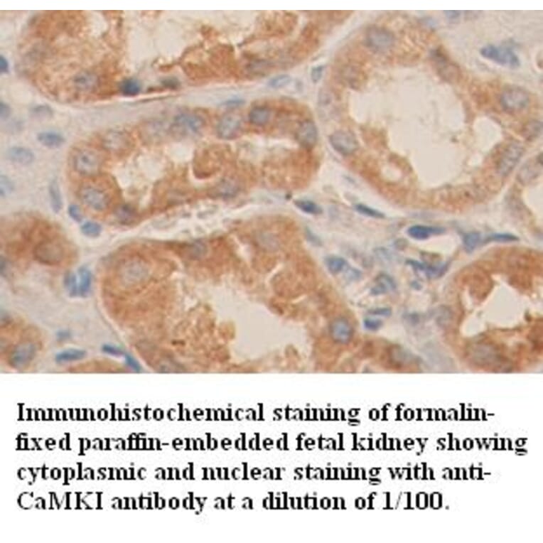 CaMKI Antibody from Signalway Antibody (39358) - Antibodies.com