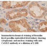 CaMKI Antibody from Signalway Antibody (39358) - Antibodies.com